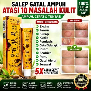 Ampuh Salap Gatal Cina Cap Orang Tua Atasi Gatal Eksim Kurap Kudis Jamus Alergi Ruam Prosiasis Kutu Air Gatal Selangkangan